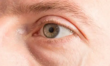 comment se debarrasser poches sous yeux 17195 l750 h512